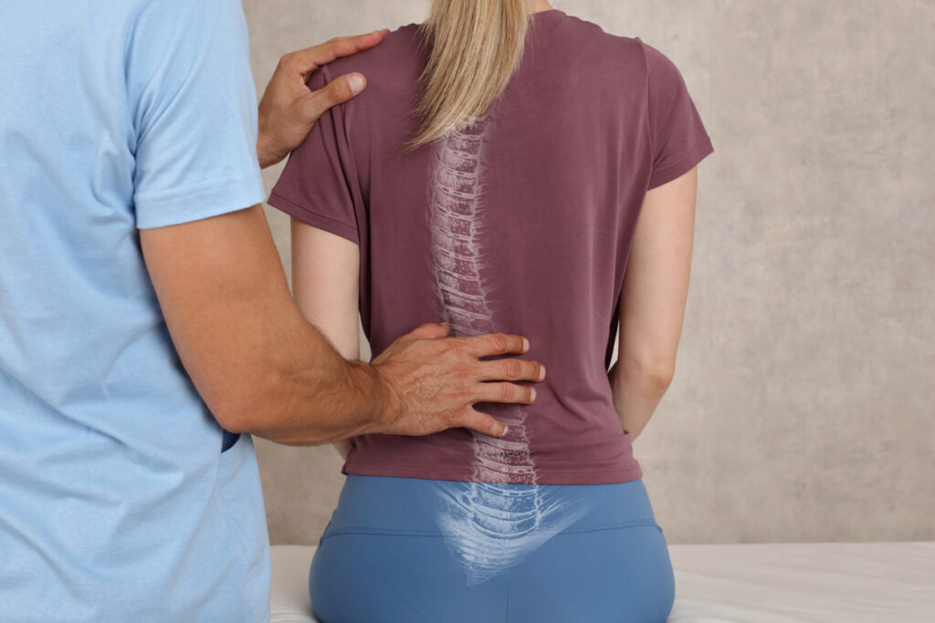 treating scoliosis